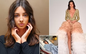 Lucy Markovic - Á quân "Next Top Model" qua đời tuổi 27 sau hành trình chiến đấu bệnh tật