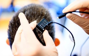 Đột phá thiết bị cấy ghép não AI giúp người câm nói và hát