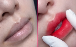 Thẩm mỹ viện Seoul Center - Điểm đến phun môi đẹp tự nhiên, bền màu