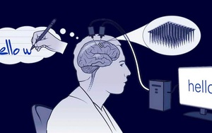 Trí tuệ nhân tạo: Công nghệ AI chuyển sóng não thành văn bản