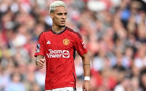 Antony chấp nhận 'đau thương' để chốt tương lai 