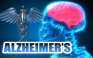 Phát hiện cơ chế giúp não tự làm sạch, mở ra hy vọng chữa Alzheimer