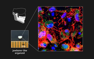Đại học Kyoto chế tạo thành công xương hàm từ tế bào iPS