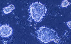 Nhật Bản thử nghiệm thành công phương pháp mới điều trị bệnh Parkinson