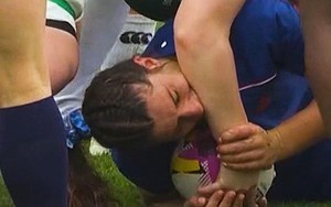 Cầu thủ nữ bị cáo buộc cắn đối thủ ở tứ kết World Cup