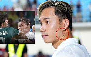 Supachok bị trầy xước cổ khi ẩu đả với cầu thủ Iraq, chỉ trích đối thủ vì pha phạm lỗi với 'Messi Thái'