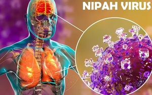 Việt Nam chưa xuất hiện ca mắc virus Nipah, Bộ Y tế sẵn sàng các biện pháp ứng phó