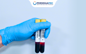 Thai 16 tuần có làm xét nghiệm NIPT được không? Giải đáp từ chuyên gia Di truyền