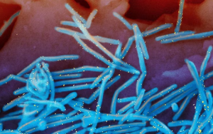 Pháp ghi nhận ca nhiễm virus hiếm gặp ở người