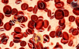 WHO: Có thể phòng ngừa tới 40% số ca ung thư trên toàn cầu