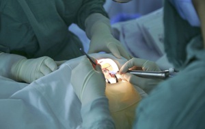 Xóa bỏ "màn sương" đục thể thủy tinh nhờ những tiến bộ của y học hiện đại