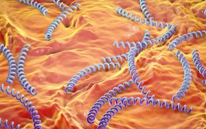 Nam thanh niên mắc giang mai bội nhiễm sau quan hệ tình dục không an toàn