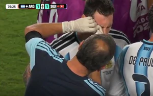 Messi bị rách mí mắt ở trận gặp Thụy Sĩ nhưng vẫn kiên cường thi đấu hết trận 