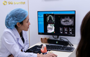 7 sai lầm nhiều người mắc phải sau khi trồng răng Implant và cách tránh để Implant bền lâu