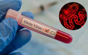 Không nên hoang mang trước những thông tin chưa kiểm chứng về bệnh do virus Ebola