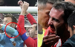 Kinh hoàng cảnh ‘răng đi, lợi ở lại’ của Diego Godin