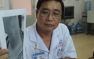 Căng da mặt tại spa, người phụ nữ bị viêm nhiễm nghiêm trọng