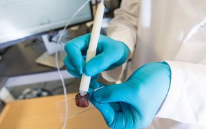 Bước đột phá chưa từng có trong chẩn đoán ung thư