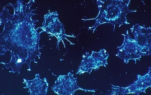 Phát hiện loại protein kích thích sự phát triển của khối u ung thư