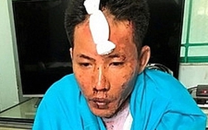 Bị đổ xăng đốt, hai cháu bé chết thảm, mẹ nguy kịch