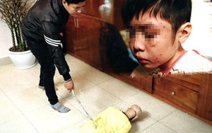 Vụ bé trai 10 tuổi bị bạo hành: Bố đẻ và 'dì ghẻ' lĩnh án tù