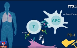 Liệu pháp miễn dịch chống ung thư vừa nhận Giải Nobel Y học đã ứng dụng tại Việt Nam