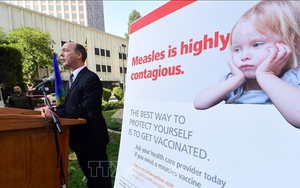 Một địa phương ở Mỹ cấm trẻ chưa tiêm phòng sởi đến các khu vực công cộng