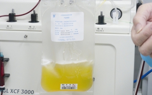 Dịch COVID-19: Huyết tương của người khỏi bệnh có tác dụng tích cực trong điều trị