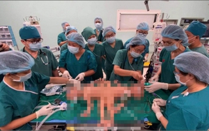 Bác sĩ 8 bệnh viện lớn tại TP.HCM cùng tham gia cuộc 'đại phẫu' cho cặp song sinh dính nhau