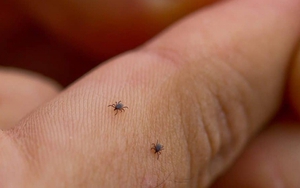 Phát hiện thêm chủng virus mới gây tử vong ở Trung Quốc