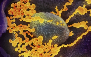 Các nhà khoa học tìm ra cách COVID-19 né tránh miễn dịch