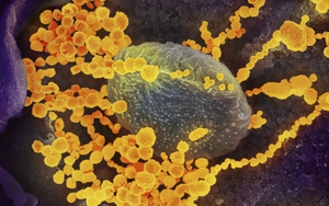 Nhân viên quán bar Sunny mắc Covid-19 là biến thể virus từ Ấn Độ