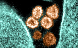 Tình báo Mỹ nói gì về nguồn gốc virus SARS-CoV-2?