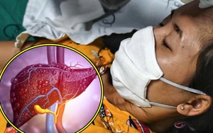 Chuyên gia nhận định bệnh viêm gan bí ẩn có khả năng cao vào Việt Nam