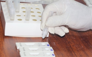 Nhiều bất thường trong việc mua sắm trang thiết bị, vật tư y tế phòng, chống dịch Covid-19 tại Bà Rịa-Vũng Tàu