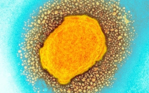 WHO đánh giá nguy cơ bệnh đậu mùa khỉ lây lan qua đường tình dục