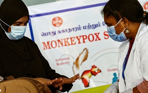 Thế giới bước vào cuộc chiến mới với bệnh đậu mùa khỉ
