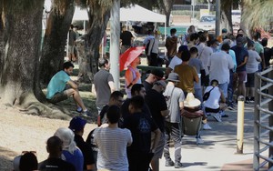 Mỹ ghi nhận ca tử vong đầu tiên vì bệnh đậu mùa khỉ