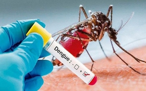 Khi nào nên test nhanh phát hiện sốt xuất huyết?