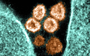 Chuyên gia cảnh báo về sự nguy hiểm của biến thể Delta