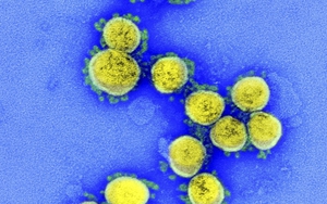 Bằng chứng SARS-CoV-2 đã xuất hiện tại Mỹ từ tháng 12/2019