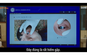 'Trò đùa của Thượng Đế 5' tập 9, 10: Căn bệnh hiếm gặp đáng sợ nhất đã xuất hiện!