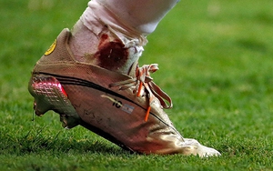 Brazil vs Argentina: Khiêu vũ cùng Messi nào Argentina!