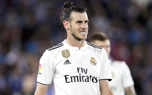 Giao tiếp kém là vấn đề của Bale