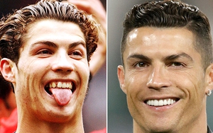 Những sao bóng đá thăng hạng “lên đời” nhờ… chỉnh răng