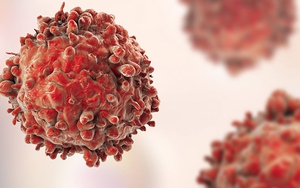 Nga tìm ra cách tiêu diệt tế bào ung thư