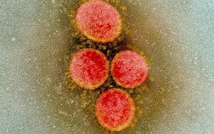 Các nhà khoa học Việt Nam - Australia hợp tác sáng tạo trong mùa dịch COVID-19