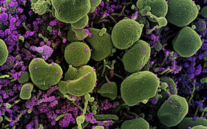 Pfizer sẽ giao thêm 100 triệu liều vắc-xin ngừa Covid-19 cho Mỹ vào tháng 7/2021