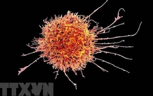 Phát hiện phương pháp mới ngăn chặn sự lây lan của tế bào ung thư não