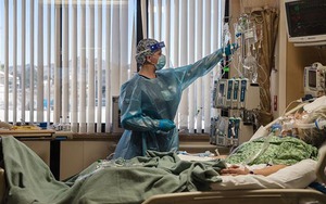 Covid-19 có thể để lại di chứng ở não người bệnh